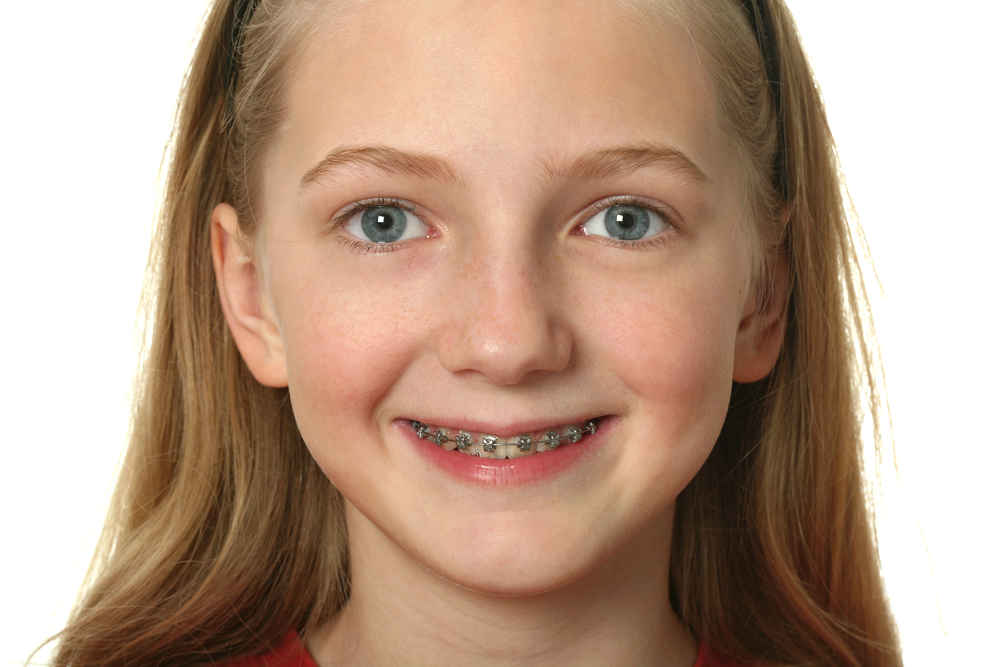 深圳儿童牙齿矫正有几种方法？