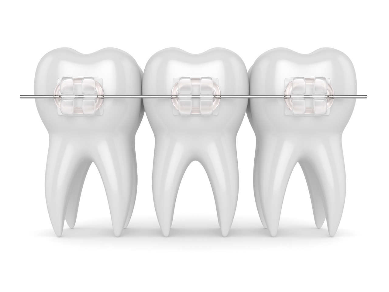 如何判断牙性还是骨性龅牙？牙性骨性龅牙怎么治疗？