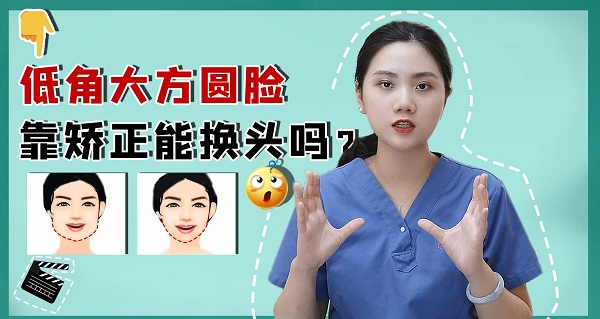深圳爱康健箍牙|低角大方圆脸靠矫正能换头吗？