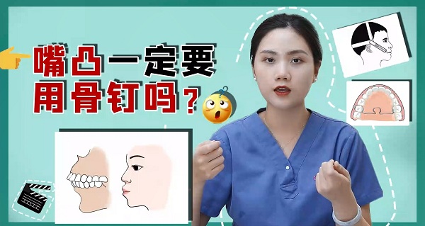 嘴凸矫正是不是一定要用骨钉呢