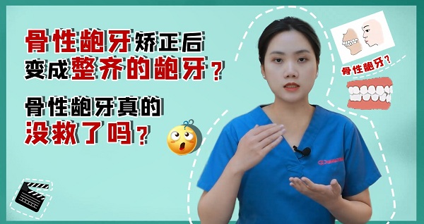 骨性龅牙真的没救了吗？