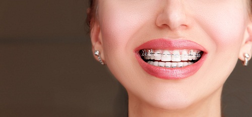 请问深圳爱康健口腔牙颌畸形的影响有哪些?