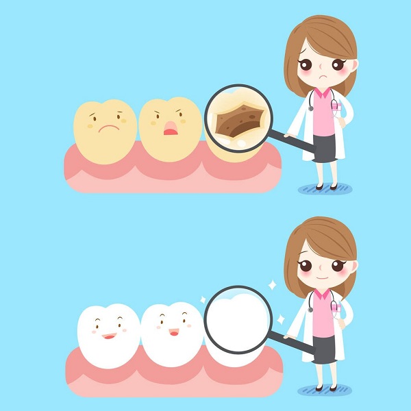 美國3m樹脂補牙多少錢一顆