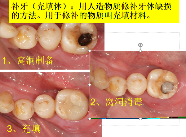 愛康健齒科