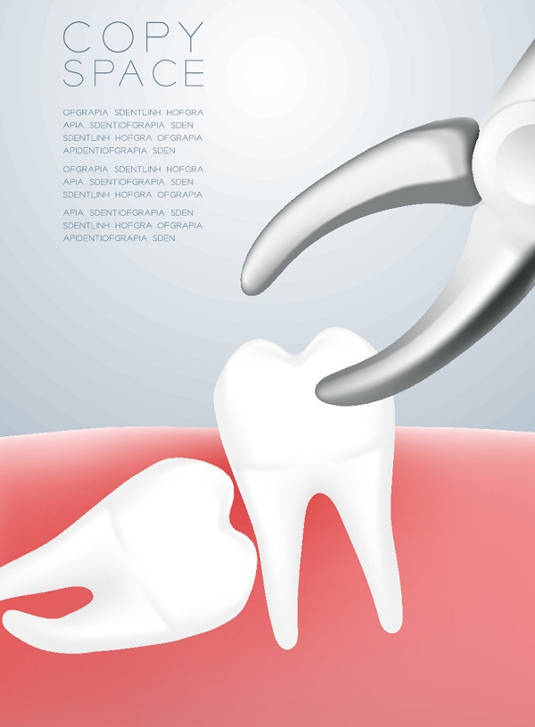 智慧齒是不是一定要拔牙
