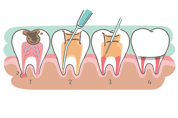深圳杜牙根邊間好