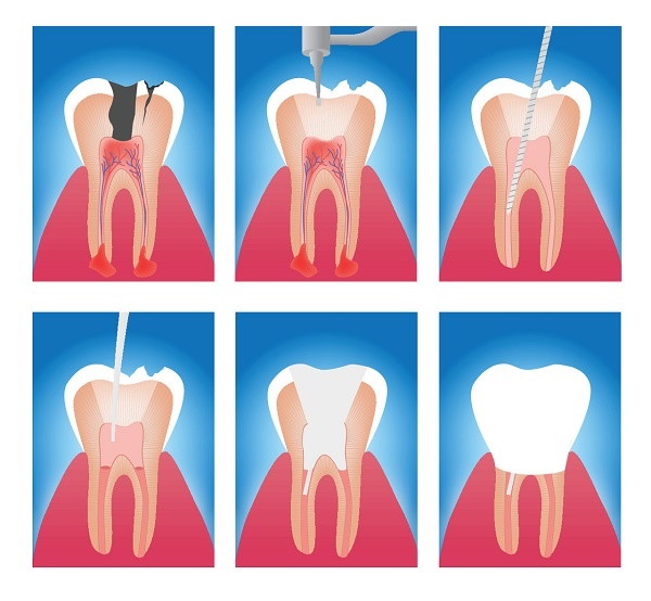 深圳杜牙根邊間好