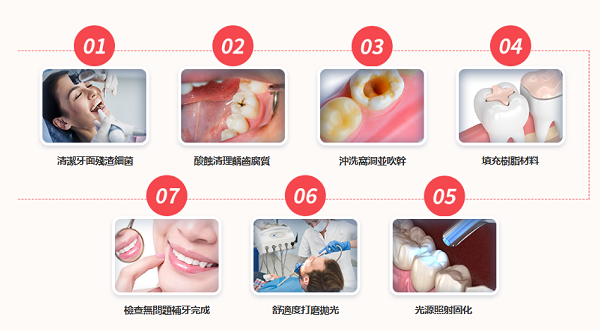 深圳樹脂補牙幾多錢一隻