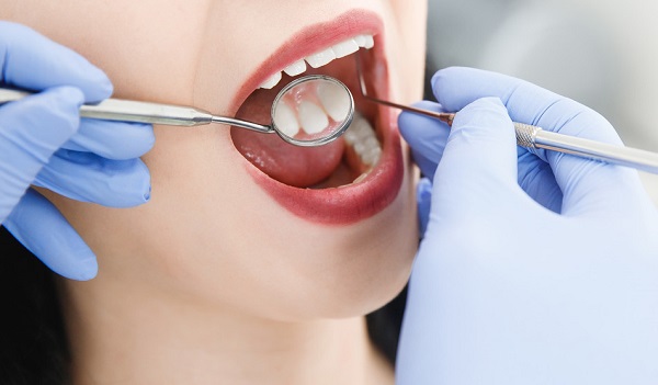 洗牙洗牙幾多錢