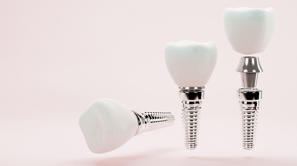 微創種植牙是甚麼