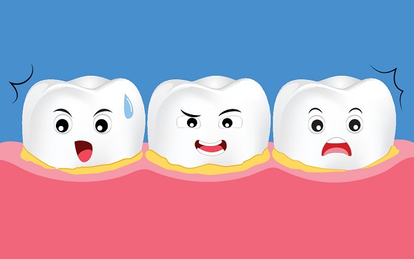 牙結石洗牙需多少錢