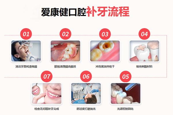 愛康健樹脂補牙全過程及步驟